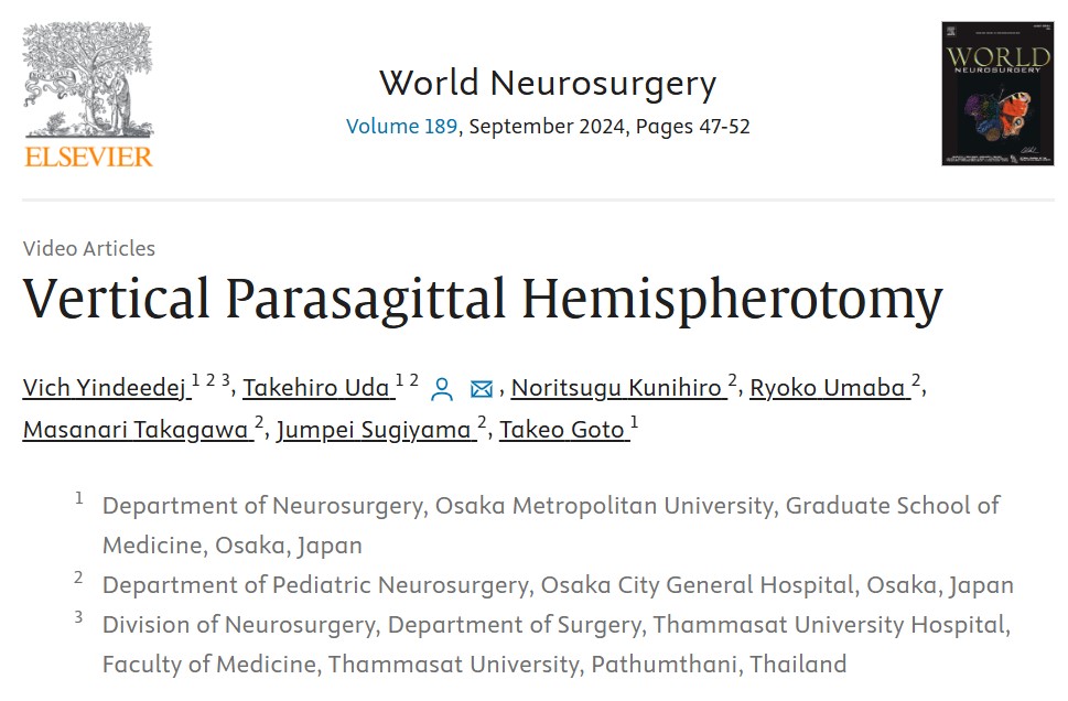 論文掲載「Vertical Parasagittal Hemispherotomy」